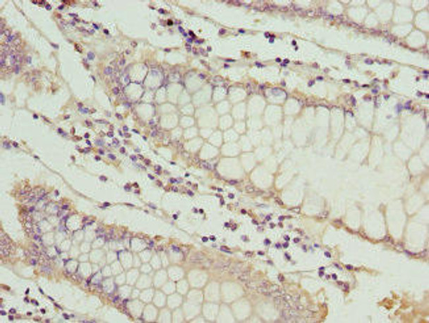 MT1G Antibody PACO33808