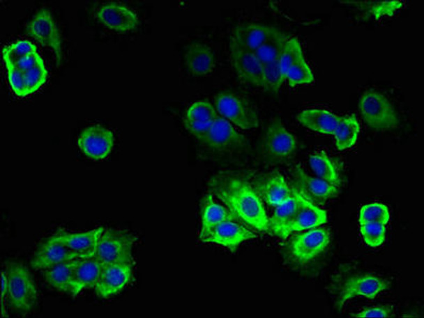 TRAM2 Antibody PACO35790