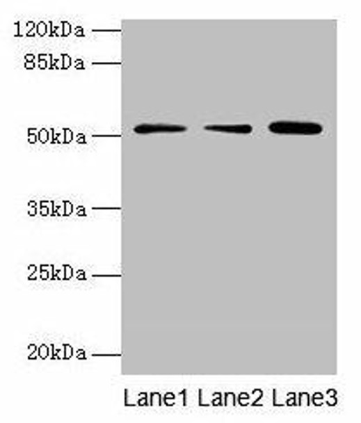 ACSBG2 Antibody PACO36122