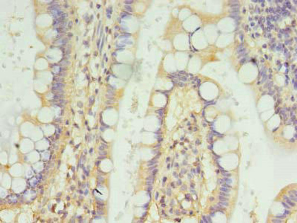 FSCB Antibody PACO36266