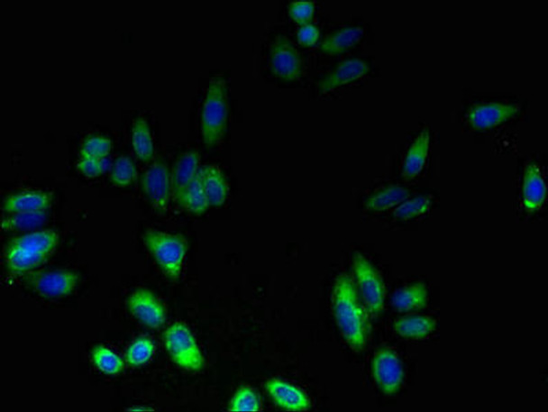 FNDC3B Antibody PACO36286