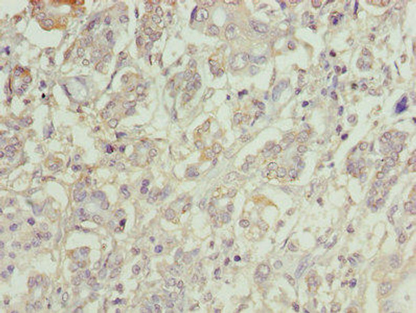 CATSPERE Antibody PACO36402