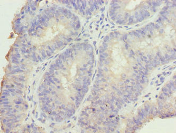 DDI2 Antibody PACO36598