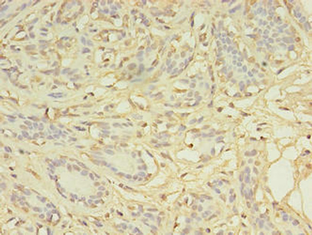 AGBL2 Antibody PACO36602