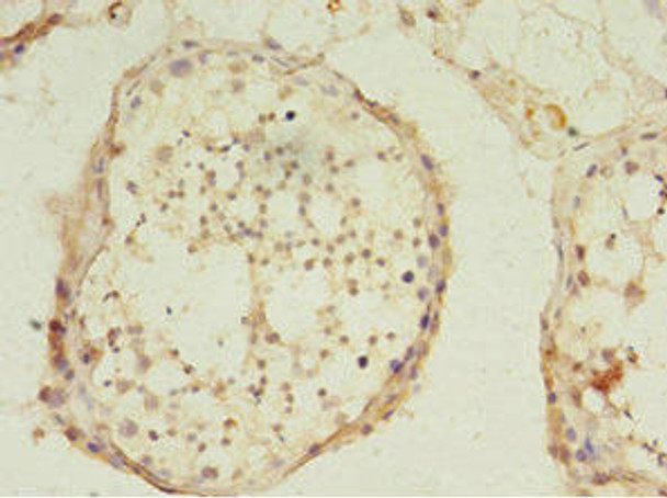 USP45 Antibody PACO36722