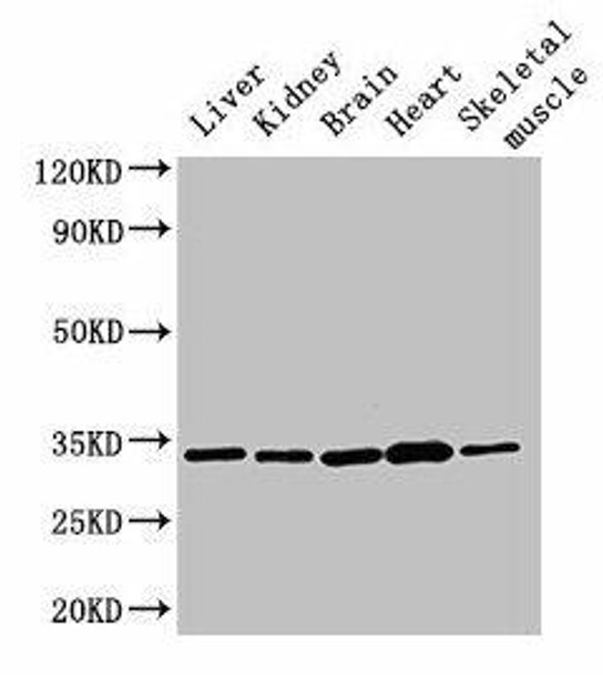 AHSA2P Antibody PACO36726