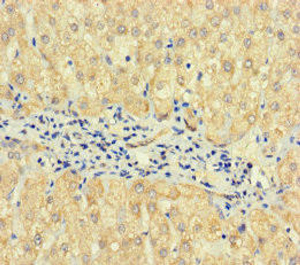 TPTE2 Antibody PACO37030