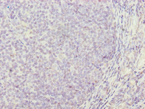 TRAT1 Antibody PACO37162