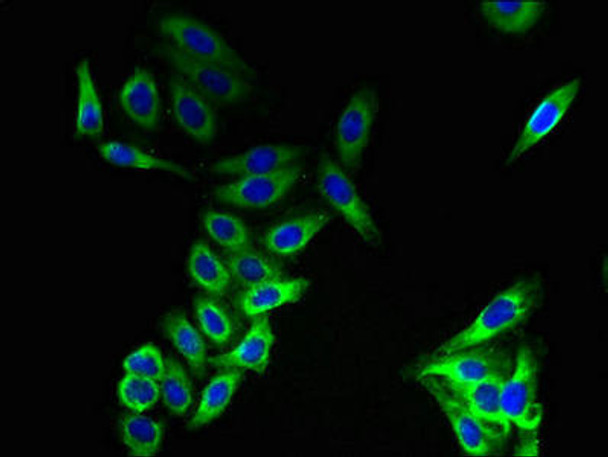 CMTM8 Antibody PACO37646