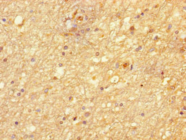 NIM1K Antibody PACO37674