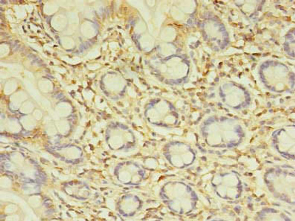 SPIC Antibody PACO37934