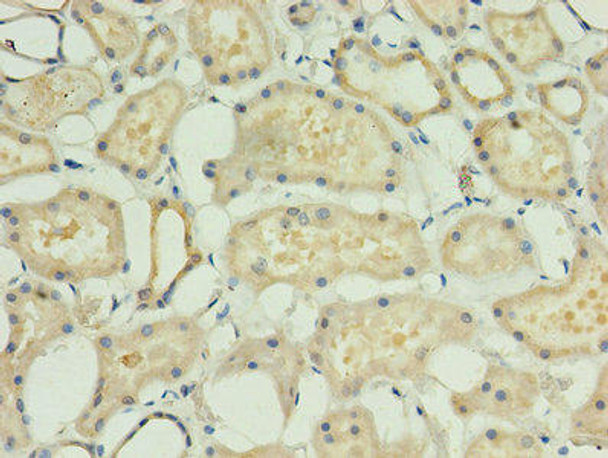 ACBD4 Antibody PACO37966