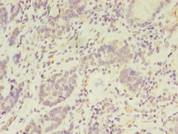 PSKH2 Antibody PACO38198