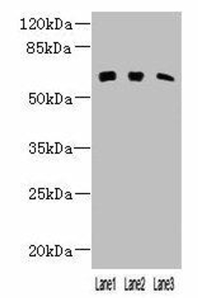 KLHL23 Antibody PACO38306