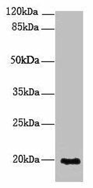 NUDT11 Antibody PACO38450