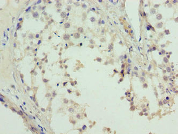 L3MBTL4 Antibody PACO38562