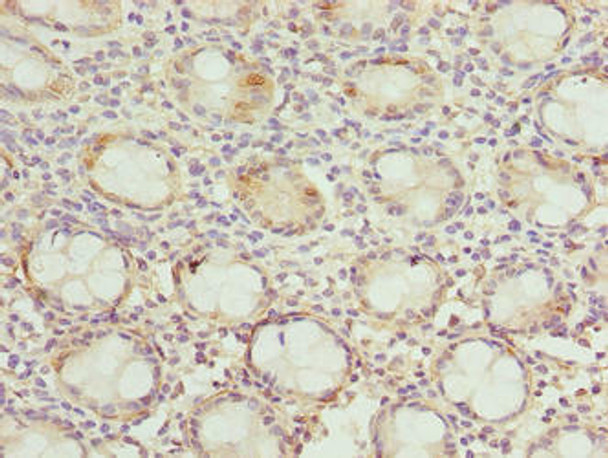 DNAJB8 Antibody PACO38590