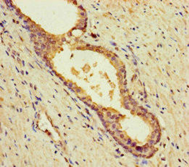 BLOC1S5 Antibody PACO38606