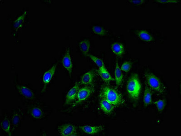 SLC38A5 Antibody PACO38626