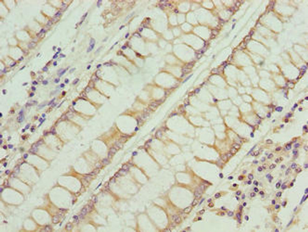 RFESD Antibody PACO38826