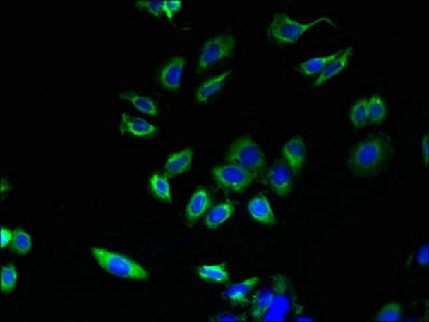 ABHD3 Antibody PACO39202