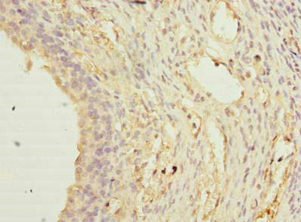 TCTEX1D2 Antibody PACO39214