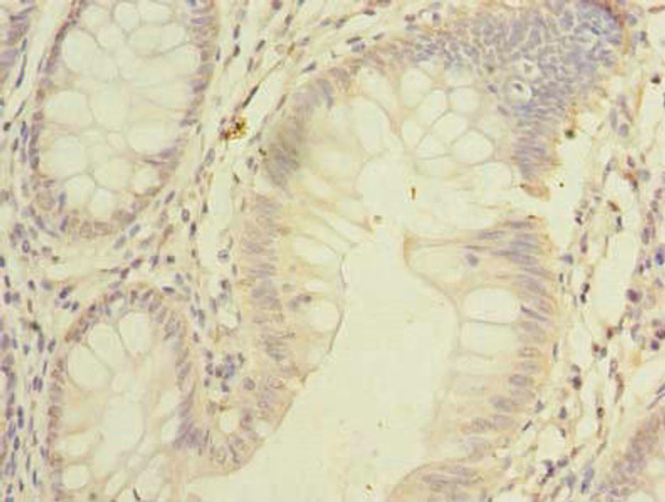 SSMEM1 Antibody PACO39218