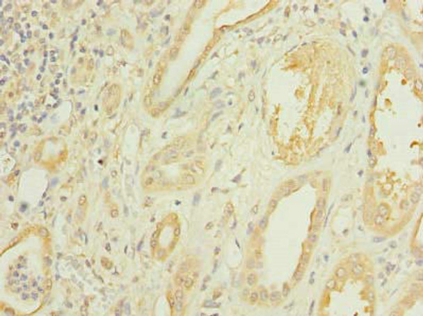 CMBL Antibody PACO39282