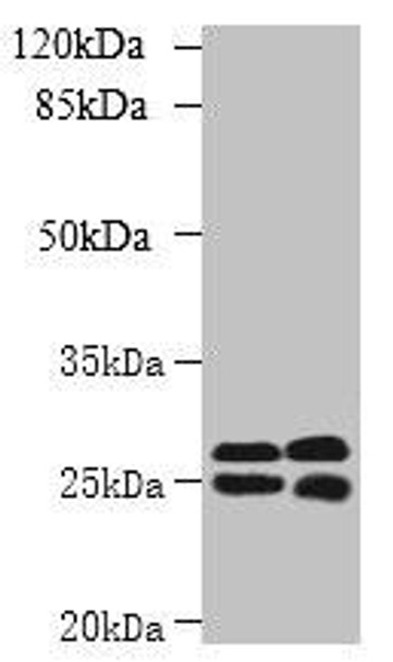 CMBL Antibody PACO39282