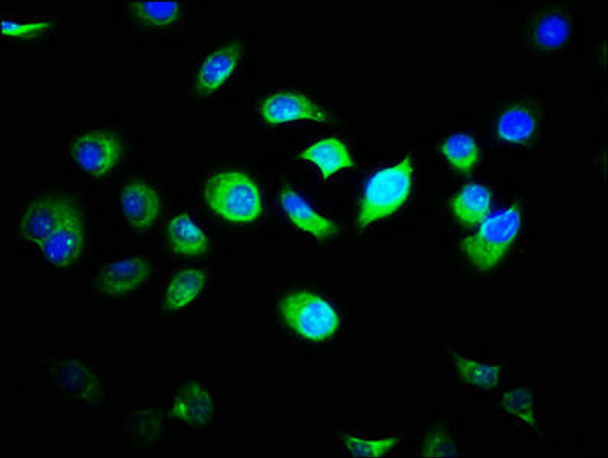 FAM89B Antibody PACO39926