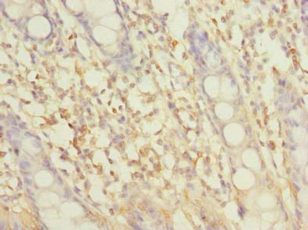SLC6A16 Antibody PACO40522
