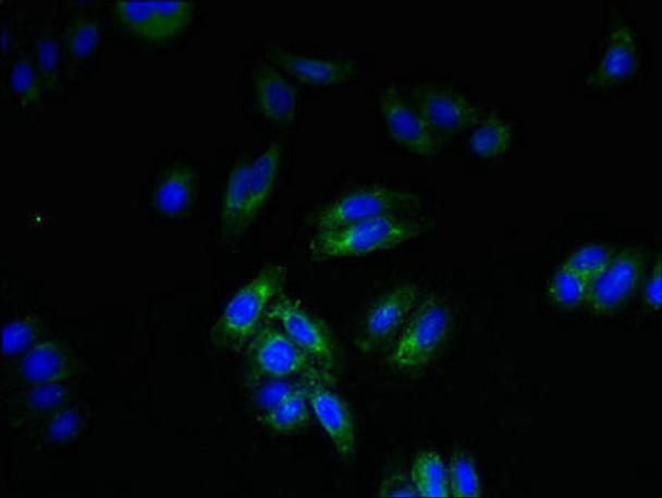 SPTLC3 Antibody PACO40658