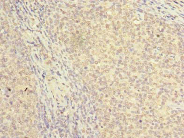 NKIRAS2 Antibody PACO41206