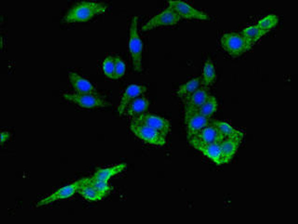 PIH1D3 Antibody PACO41386