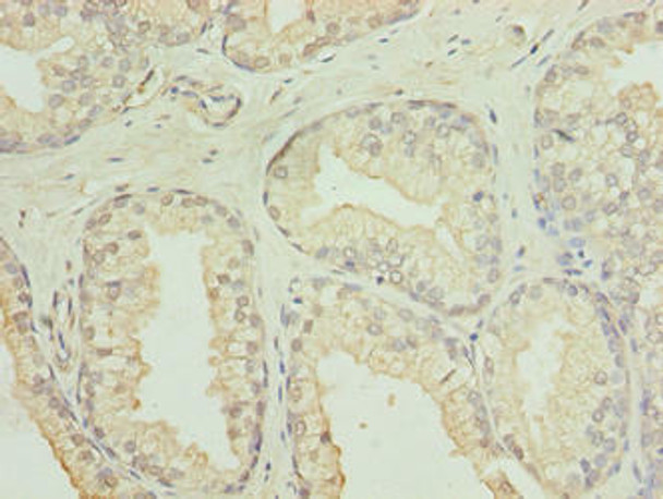 GID8 Antibody PACO41714