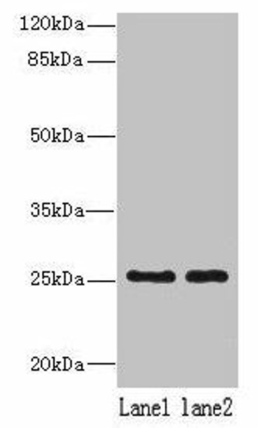 NDFIP1 Antibody PACO42094
