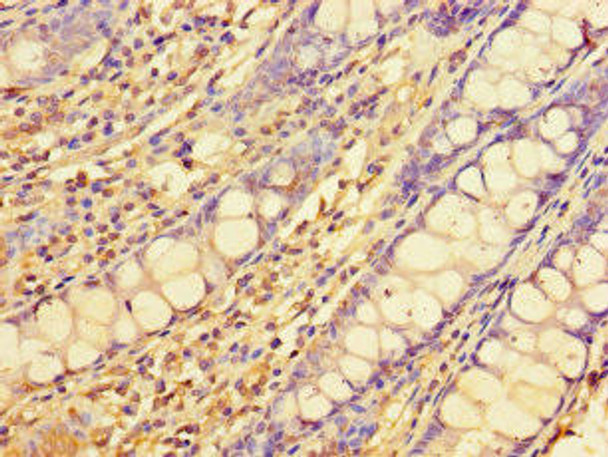 ELOVL1 Antibody PACO42118