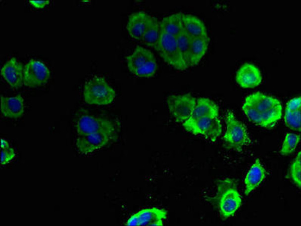 ELOVL1 Antibody PACO42118