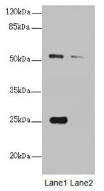 ERO1A Antibody PACO44634