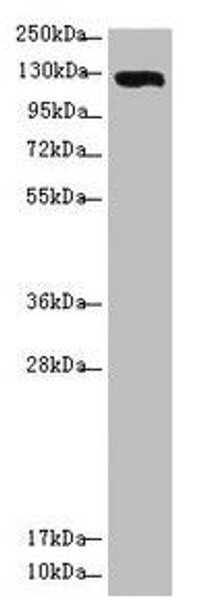 USP28 Antibody PACO45633