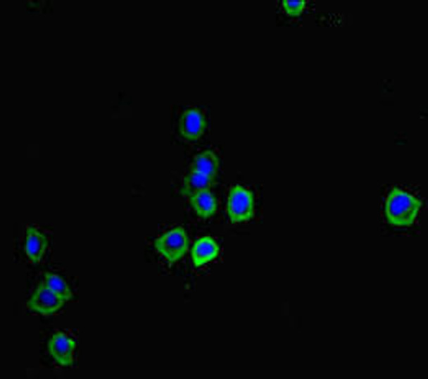 Osm Antibody PACO46598