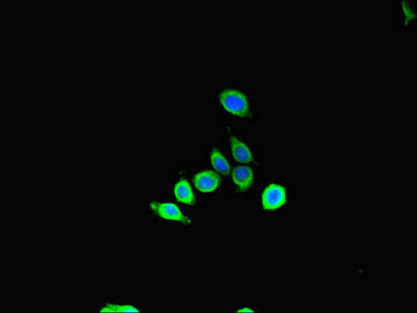 SBF2 Antibody PACO46722