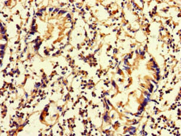 DNAAF3 Antibody PACO46962