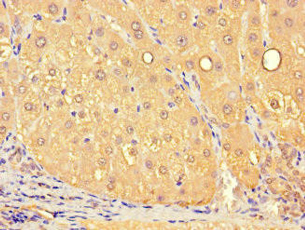 SLC25A10 Antibody PACO47162