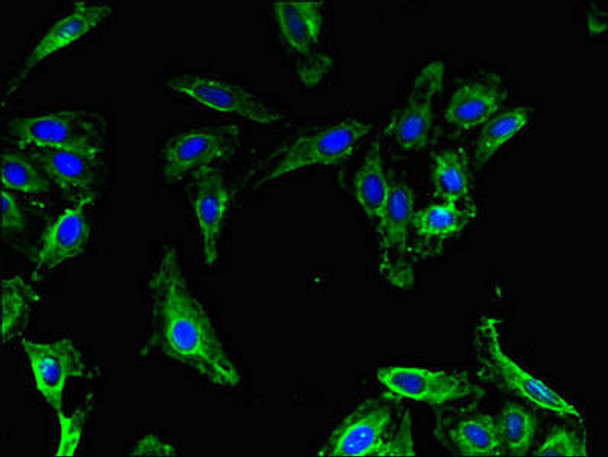 MAP1LC3B2 Antibody PACO47530