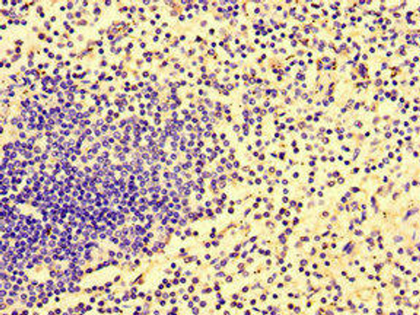 HCP5 Antibody PACO47958