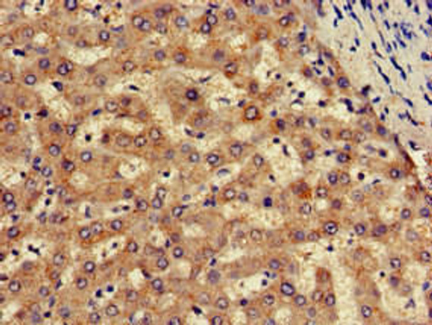 SLC13A5 Antibody PACO50718