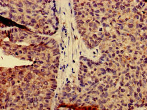 CAPN14 Antibody PACO51386