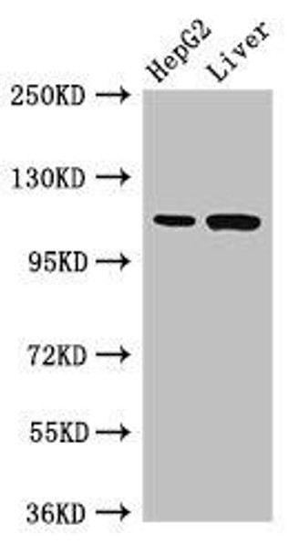 Tmprss15 Antibody PACO51878