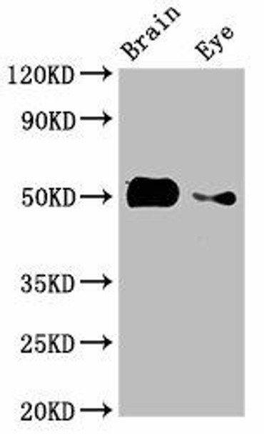 tuba8l2 Antibody PACO52106